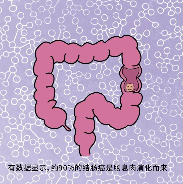 奪走“黑豹”生命的結(jié)腸癌，到底什么來(lái)頭？