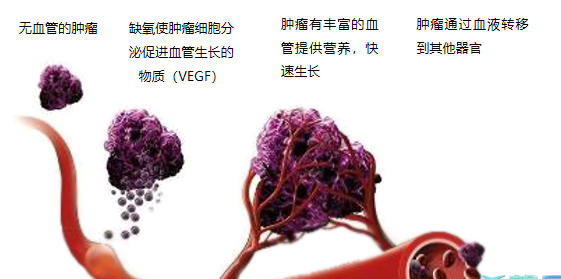 晚期腫瘤為什么會復(fù)發(fā)轉(zhuǎn)移？