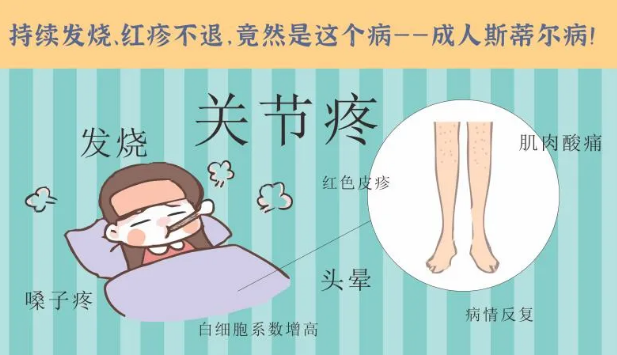 持續(xù)發(fā)燒、紅疹不退……她終于在這里治好了這個罕見病