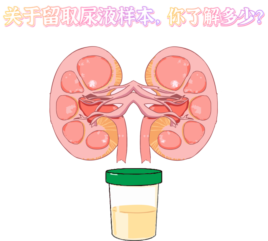 做尿檢，不得不說的注意事項！