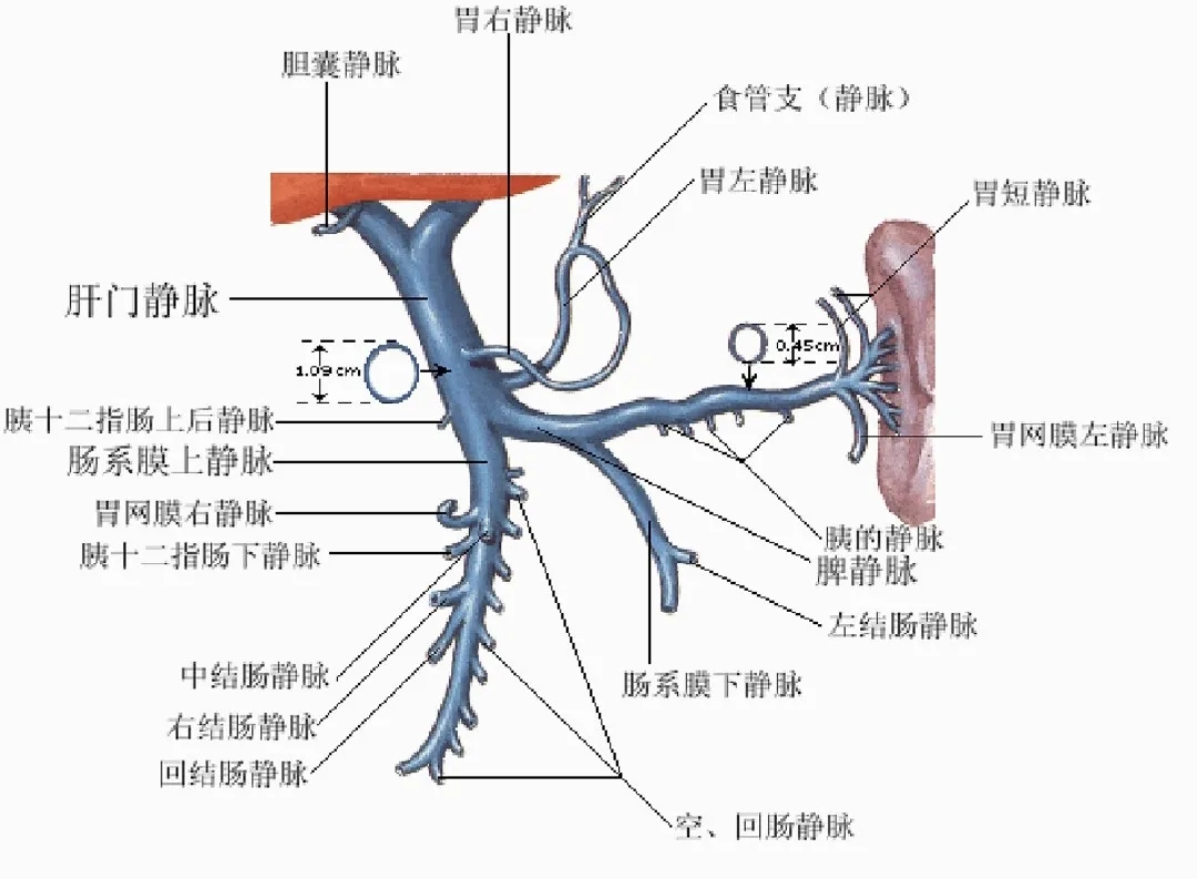 反復(fù)嘔血、黑便怎么辦？TIPS手術(shù)能解決