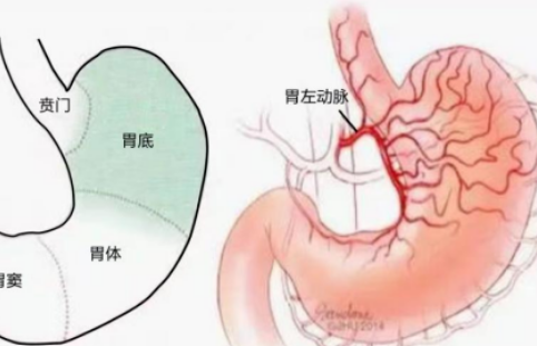 不開刀不吃藥不餓肚子，微創(chuàng)介入減肥靠譜嗎？