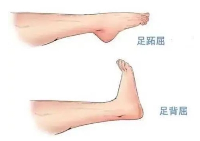 扭胯小連步、動感搖花手……“科目三”雖火，運動損傷也要防！