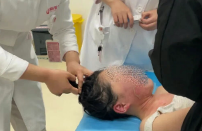 14歲，面、頸、胸燙傷，只因中午那鍋面湯…